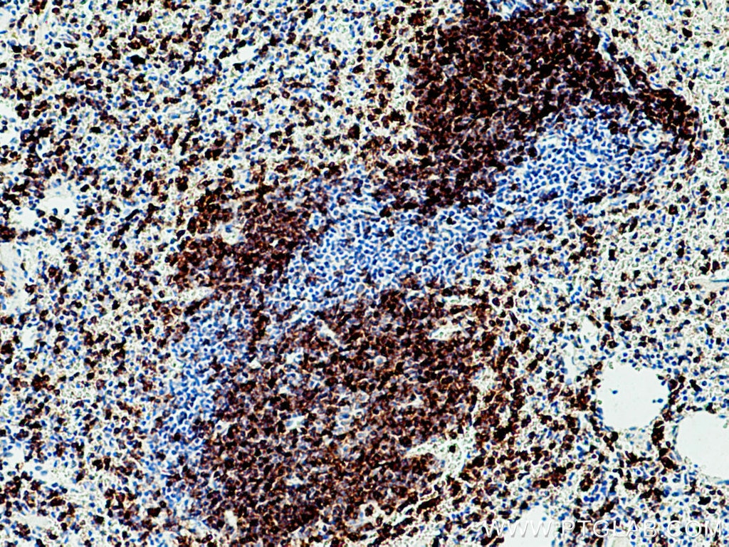 Immunohistochemistry (IHC) staining of mouse spleen tissue using CD79B Polyclonal antibody (21063-1-AP)