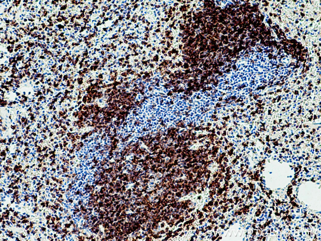 Immunohistochemistry (IHC) staining of mouse spleen tissue using CD79b Polyclonal antibody (21063-1-AP)