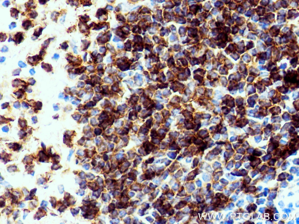 Immunohistochemistry (IHC) staining of mouse spleen tissue using CD79B Polyclonal antibody (21063-1-AP)