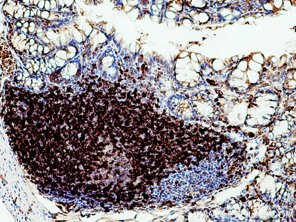 Immunohistochemistry (IHC) staining of mouse colon tissue using CD79b Polyclonal antibody (21063-1-AP)