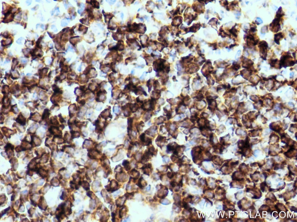 Immunohistochemistry (IHC) staining of mouse colon tissue using CD79b Polyclonal antibody (21063-1-AP)