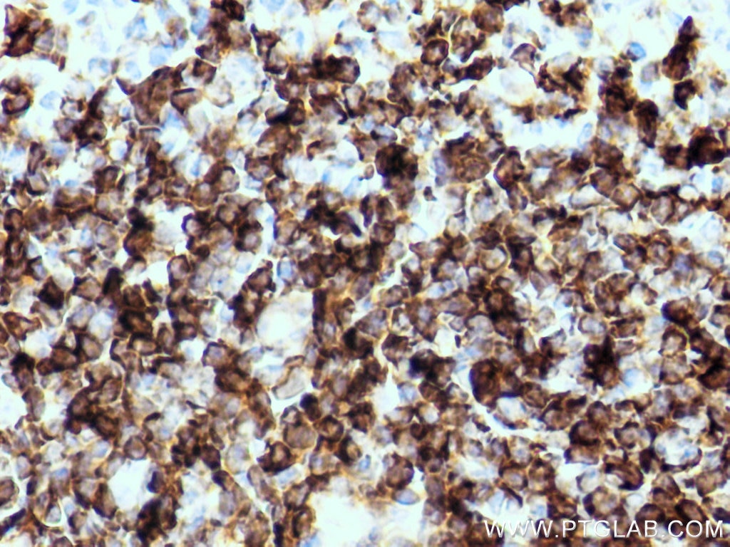 Immunohistochemistry (IHC) staining of mouse colon tissue using CD79B Polyclonal antibody (21063-1-AP)