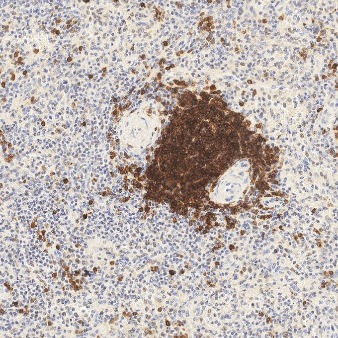 IHC staining of human spleen using 84236-4-RR Immunohistochemistry (IHC) staining of human spleen tissue using CD79a Recombinant monoclonal antibody (84236-4-RR)