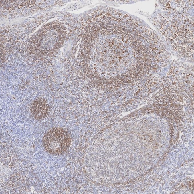 IHC staining of human tonsillitis using 84236-4-RR Immunohistochemistry (IHC) staining of human tonsillitis tissue using CD79a Recombinant monoclonal antibody (84236-4-RR)