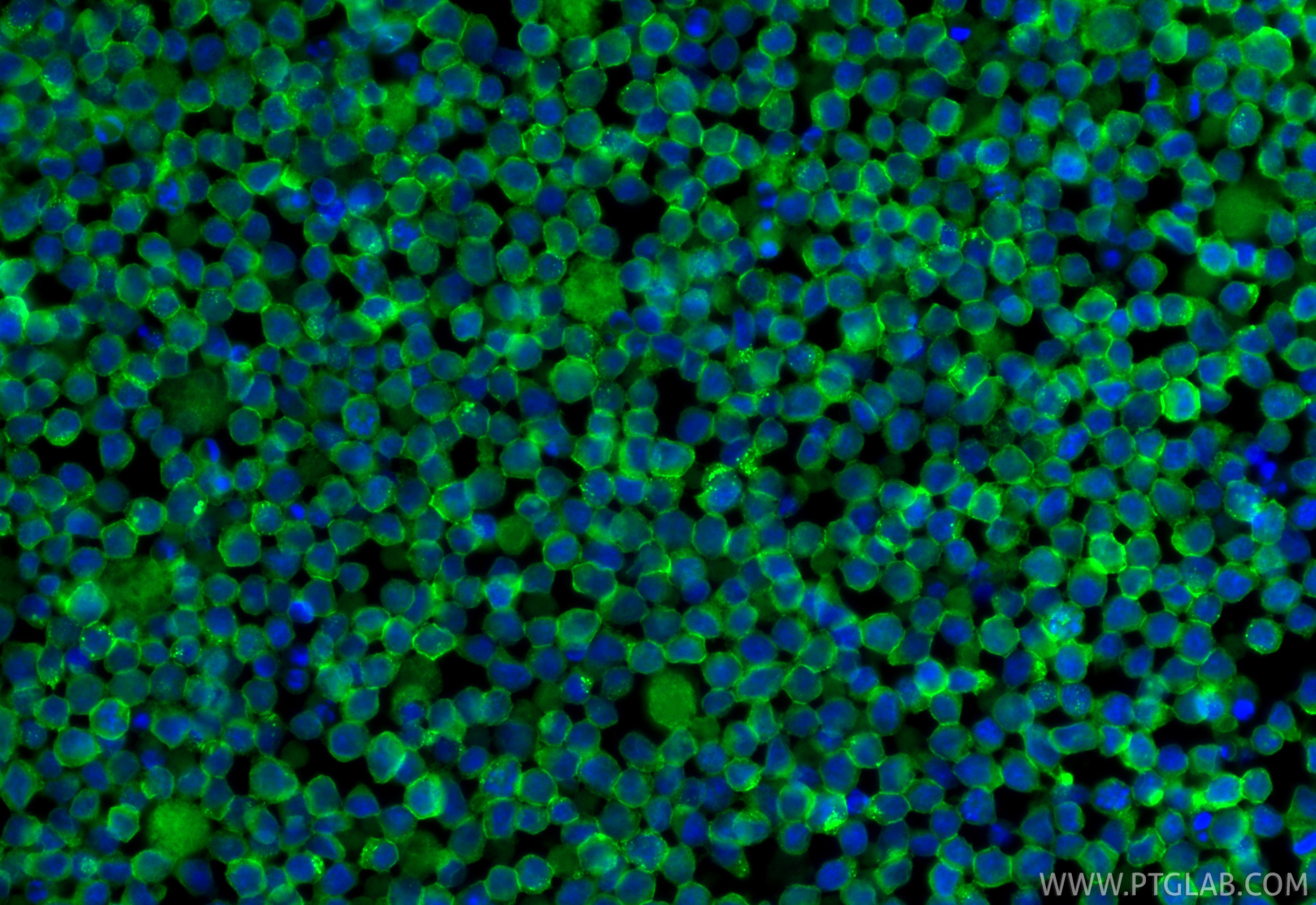 IF Staining of Ramos using CL488-84236-5 Immunofluorescence (IF) / fluorescent staining of Ramos cells using CoraLite® Plus 488-conjugated CD79a Recombinant mo (CL488-84236-5)