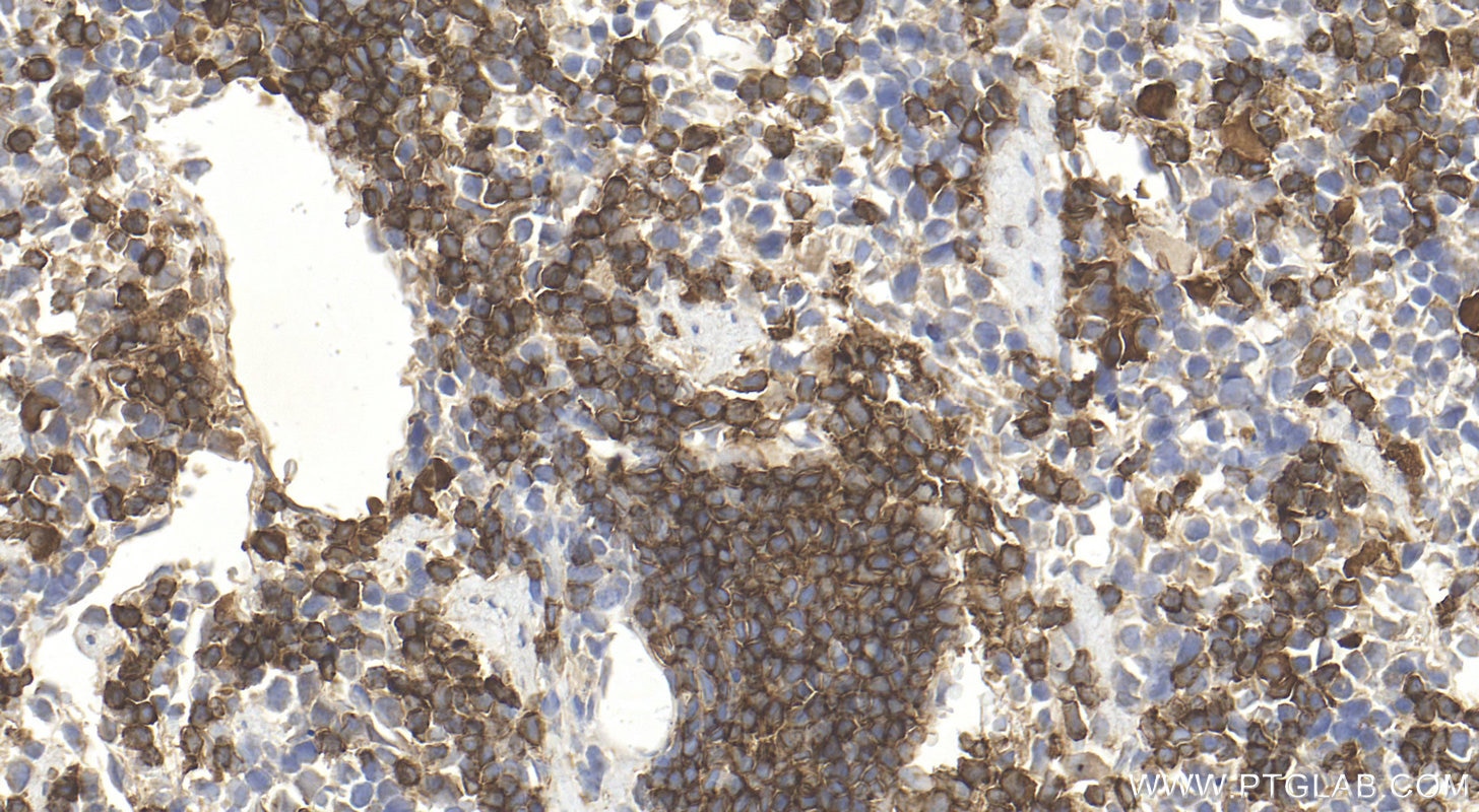 Immunohistochemistry (IHC) staining of mouse spleen tissue using CD79b Polyclonal antibody (32152-1-AP)