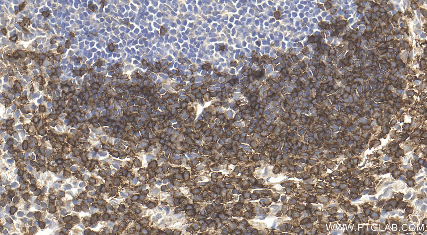 Immunohistochemistry (IHC) staining of mouse spleen tissue using CD79b Polyclonal antibody (32152-1-AP)
