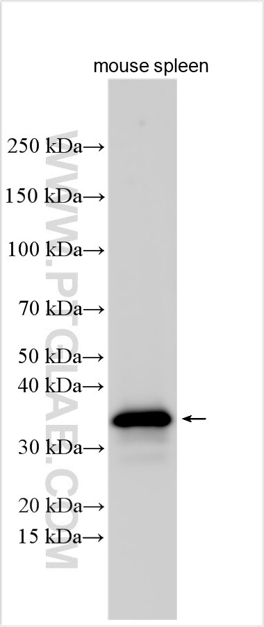 Western Blot (WB) analysis of various lysates using CD79b Polyclonal antibody (32152-1-AP)