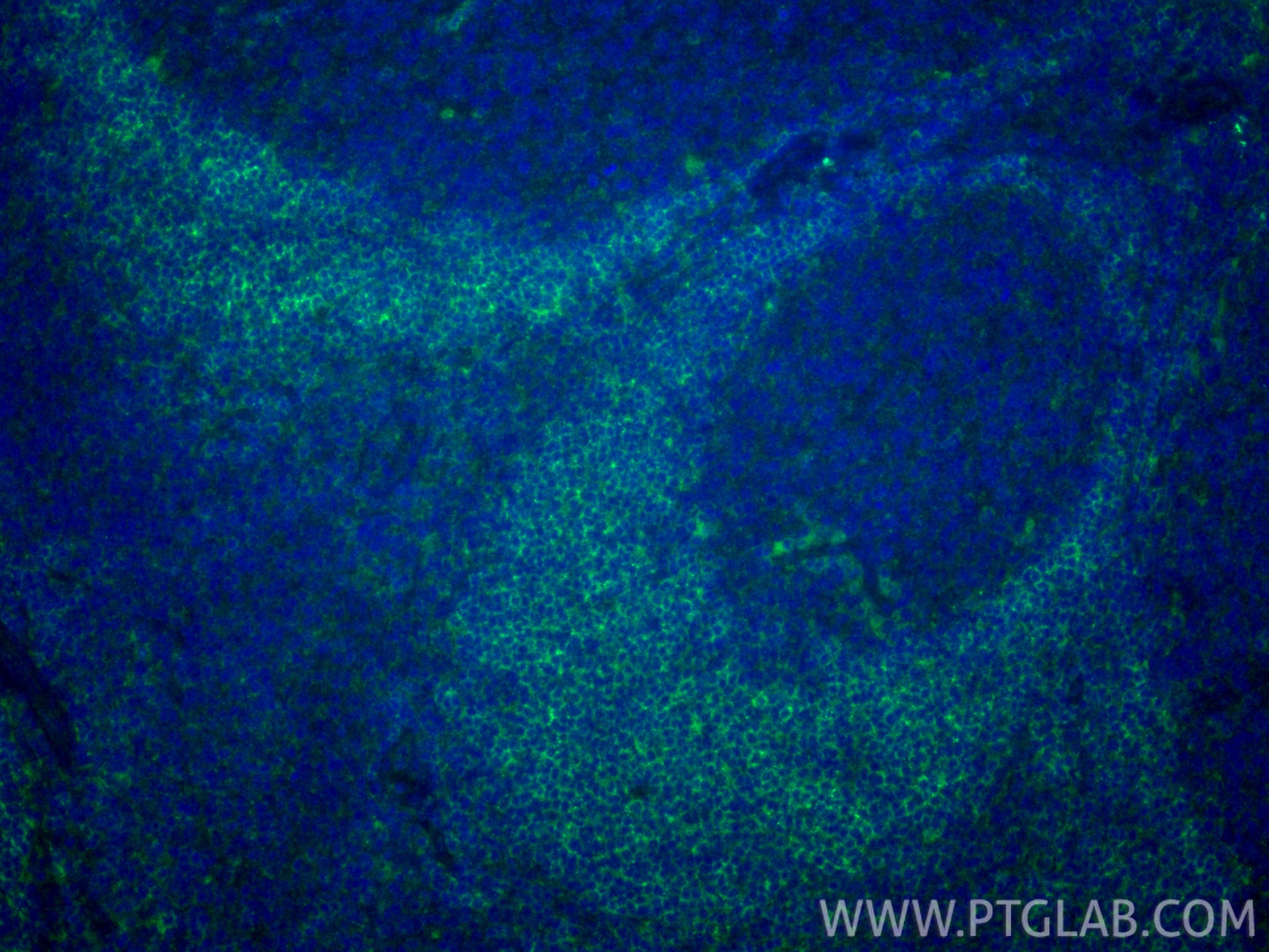 Immunofluorescence (IF) / fluorescent staining of human tonsillitis tissue using CD79b Recombinant monoclonal antibody (84234-5-RR)