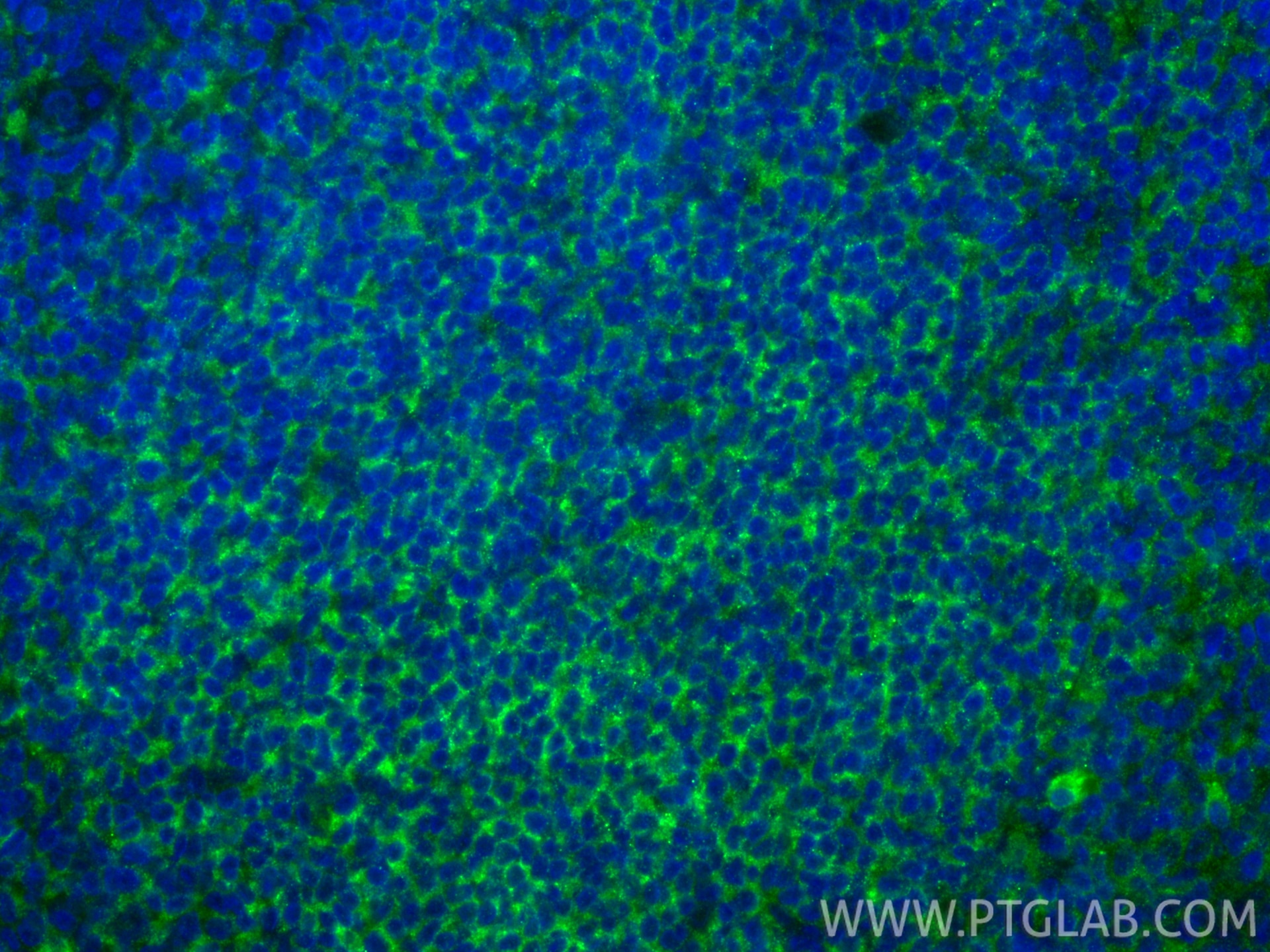 Immunofluorescence (IF) / fluorescent staining of human tonsillitis tissue using CD79b Recombinant monoclonal antibody (84234-5-RR)
