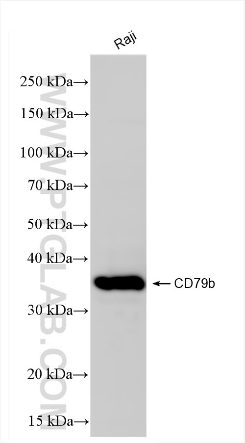 Western Blot (WB) analysis of various lysates using CD79b Recombinant antibody (84523-4-RR)