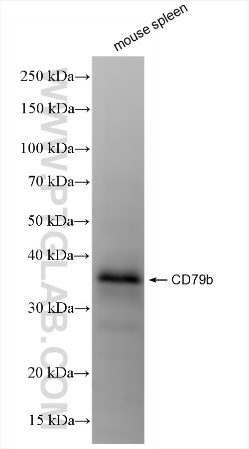 Western Blot (WB) analysis of various lysates using CD79b Recombinant antibody (84523-4-RR)