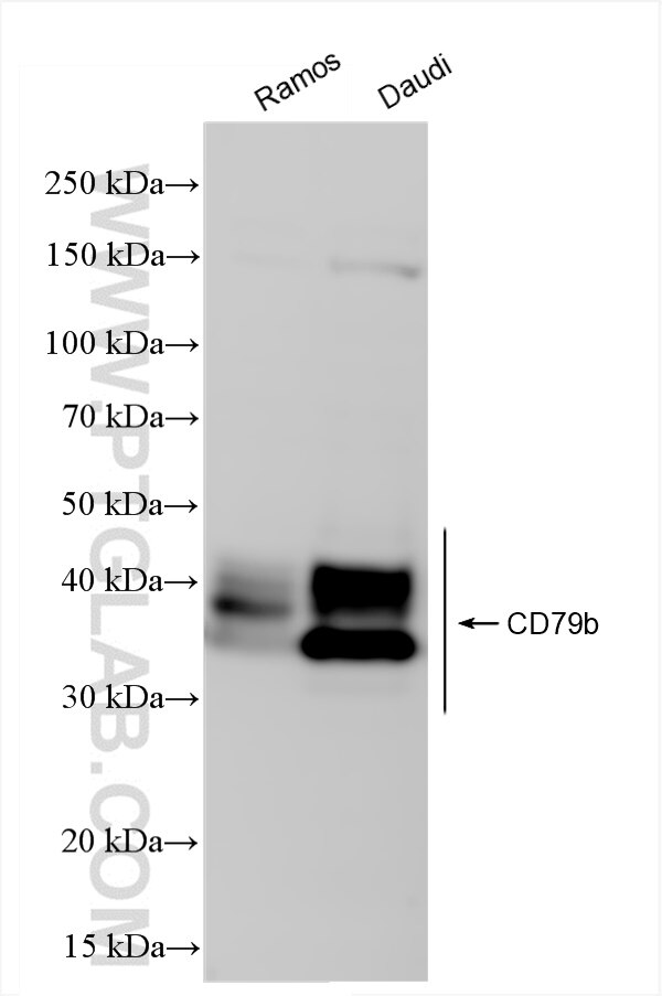 Western Blot (WB) analysis of various lysates using CD79b Recombinant antibody (84523-4-RR)