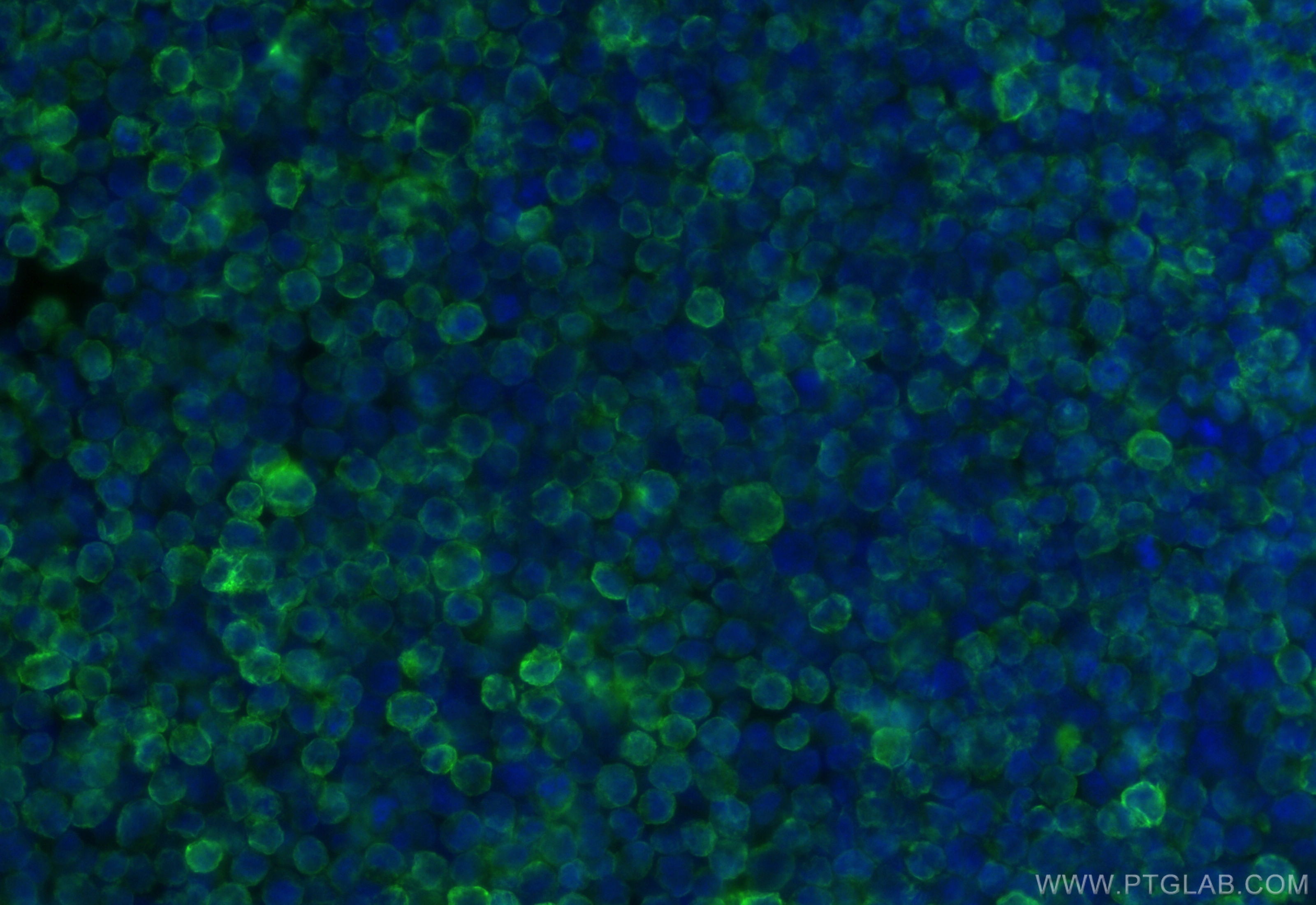 CD79b