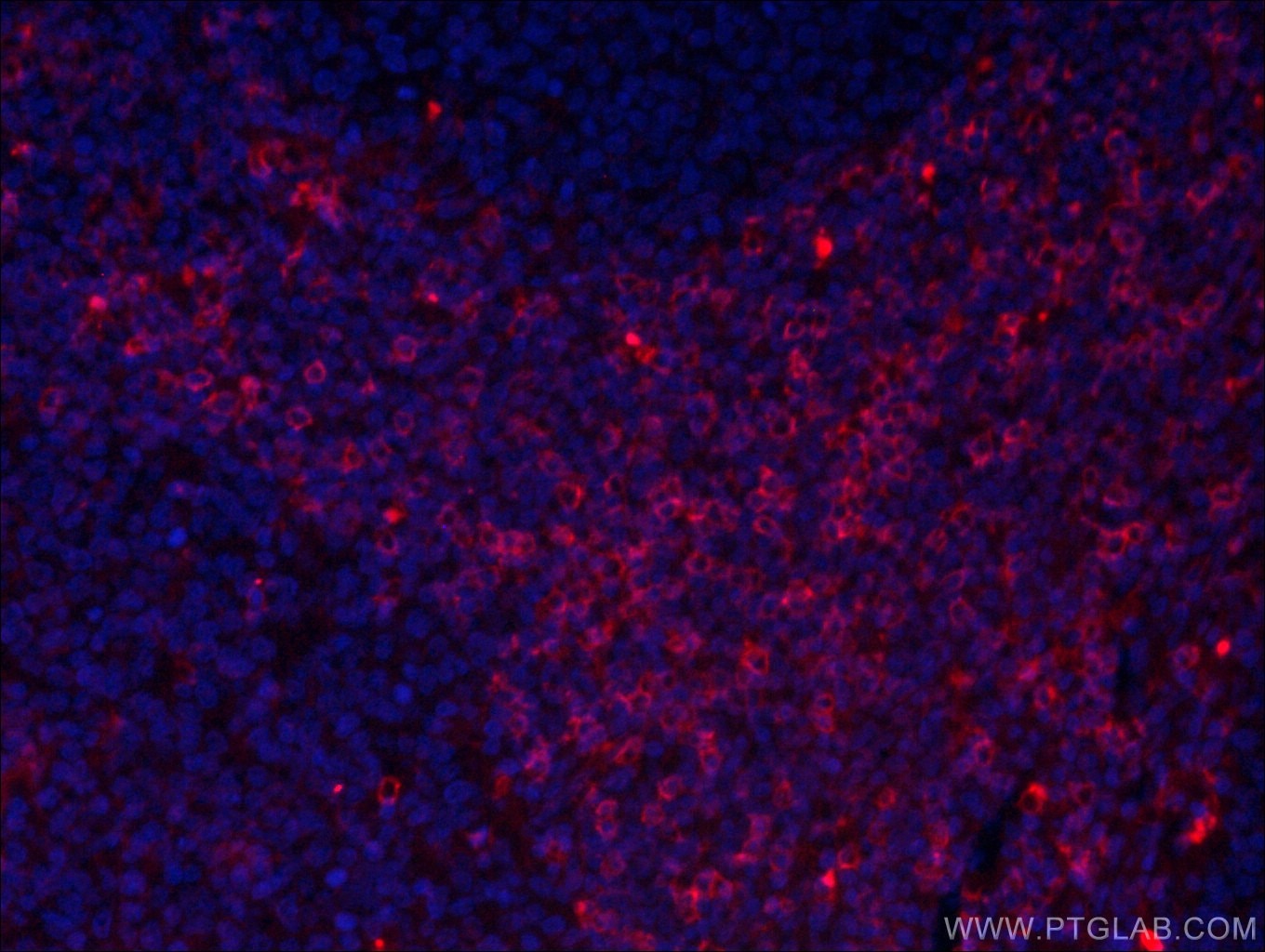 Immunofluorescence (IF) / fluorescent staining of human tonsillitis tissue using CoraLite®594-conjugated CD8a Monoclonal antibody (CL594-66868)
