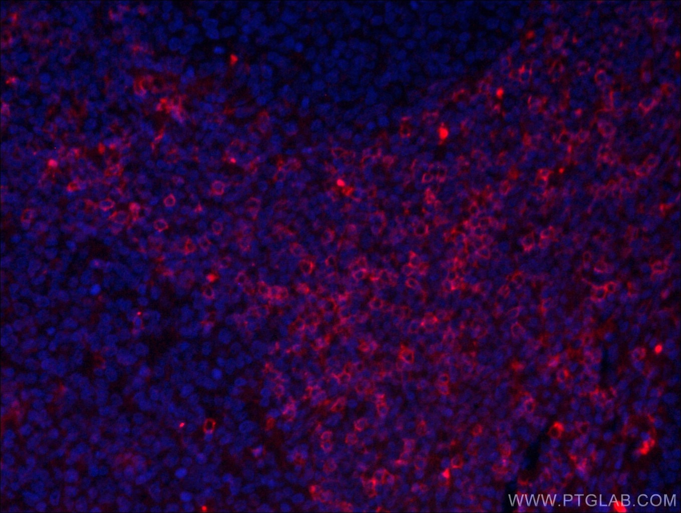 Immunofluorescence (IF) / fluorescent staining of human tonsillitis tissue using CoraLite®594-conjugated CD8 Monoclonal antibody (CL594-66868)