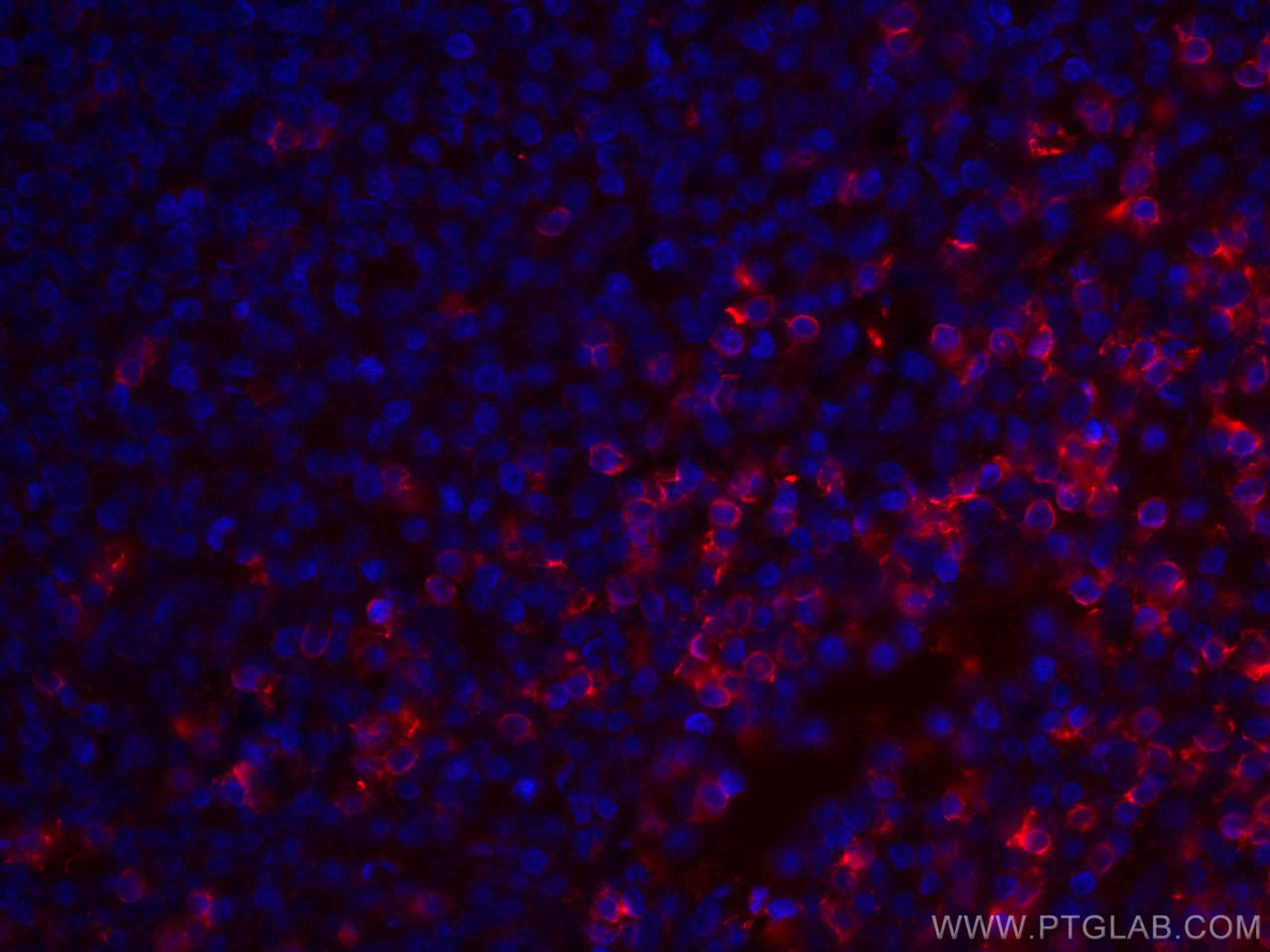 Immunofluorescence (IF) / fluorescent staining of human tonsillitis tissue using CoraLite®594-conjugated CD8a Monoclonal antibody (CL594-66868)