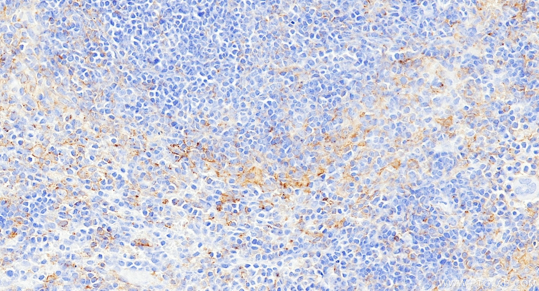 IHC staining of mouse spleen using 84137-5-RR Immunohistochemistry (IHC) staining of mouse spleen tissue using CD80 Recombinant monoclonal antibody (84137-5-RR)
