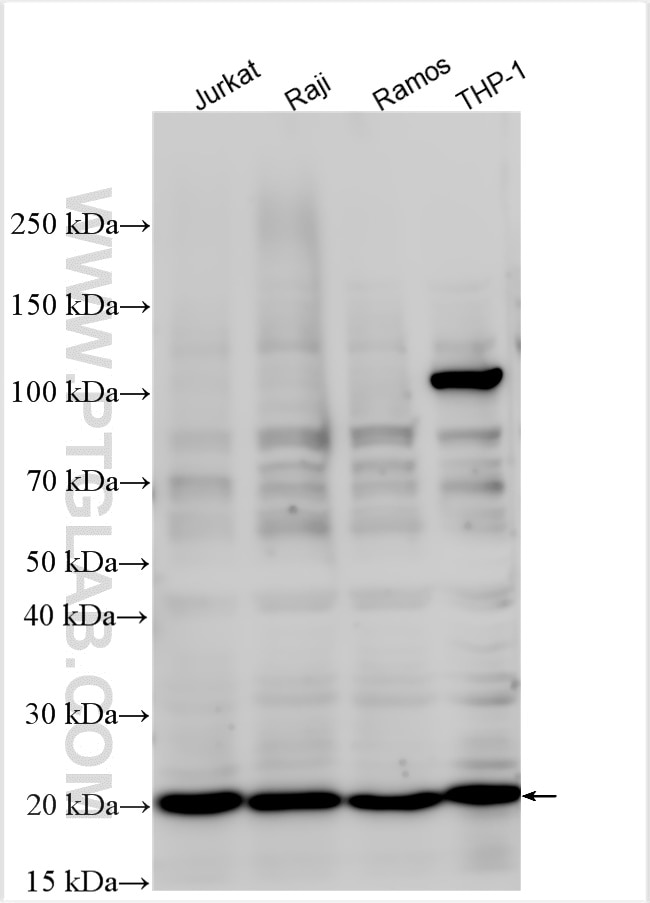 Western Blot (WB) analysis of various lysates using CD81 Polyclonal antibody (27855-1-AP)