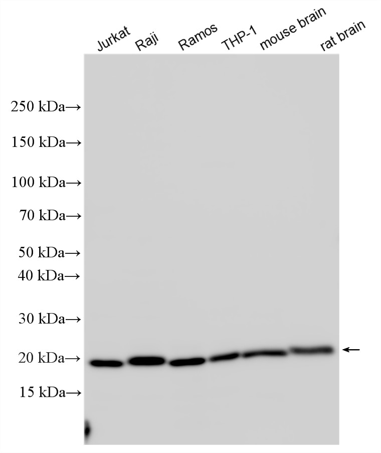 WB analysis using 27855-1-AP Western Blot (WB) analysis of various lysates using CD81 Polyclonal antibody (27855-1-AP)