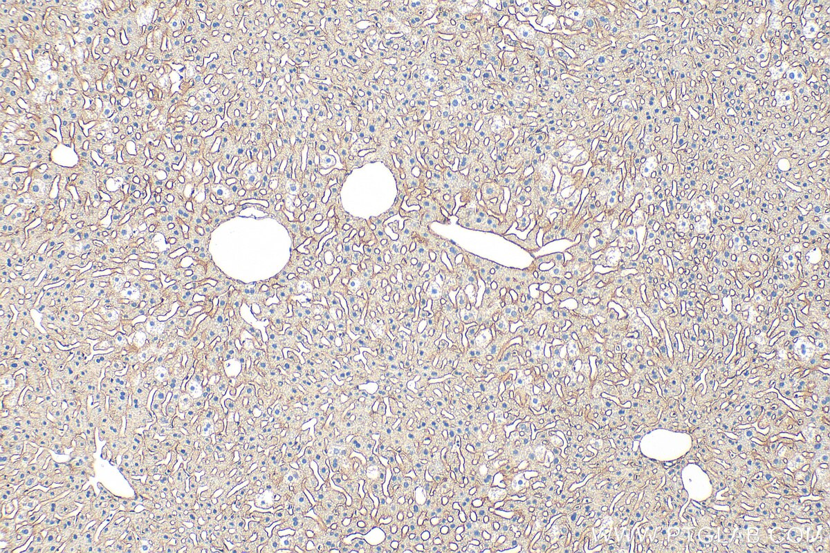 Immunohistochemistry (IHC) staining of mouse liver tissue using CD81 Polyclonal antibody (33170-1-AP)