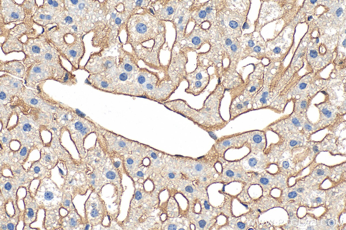 Immunohistochemistry (IHC) staining of mouse liver tissue using CD81 Polyclonal antibody (33170-1-AP)