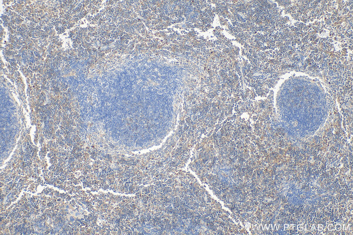Immunohistochemistry (IHC) staining of mouse spleen tissue using CD81 Polyclonal antibody (33170-1-AP)