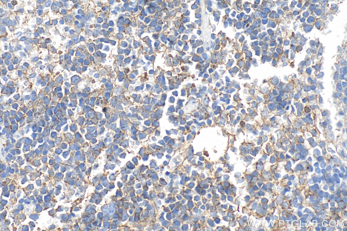 Immunohistochemistry (IHC) staining of mouse spleen tissue using CD81 Polyclonal antibody (33170-1-AP)