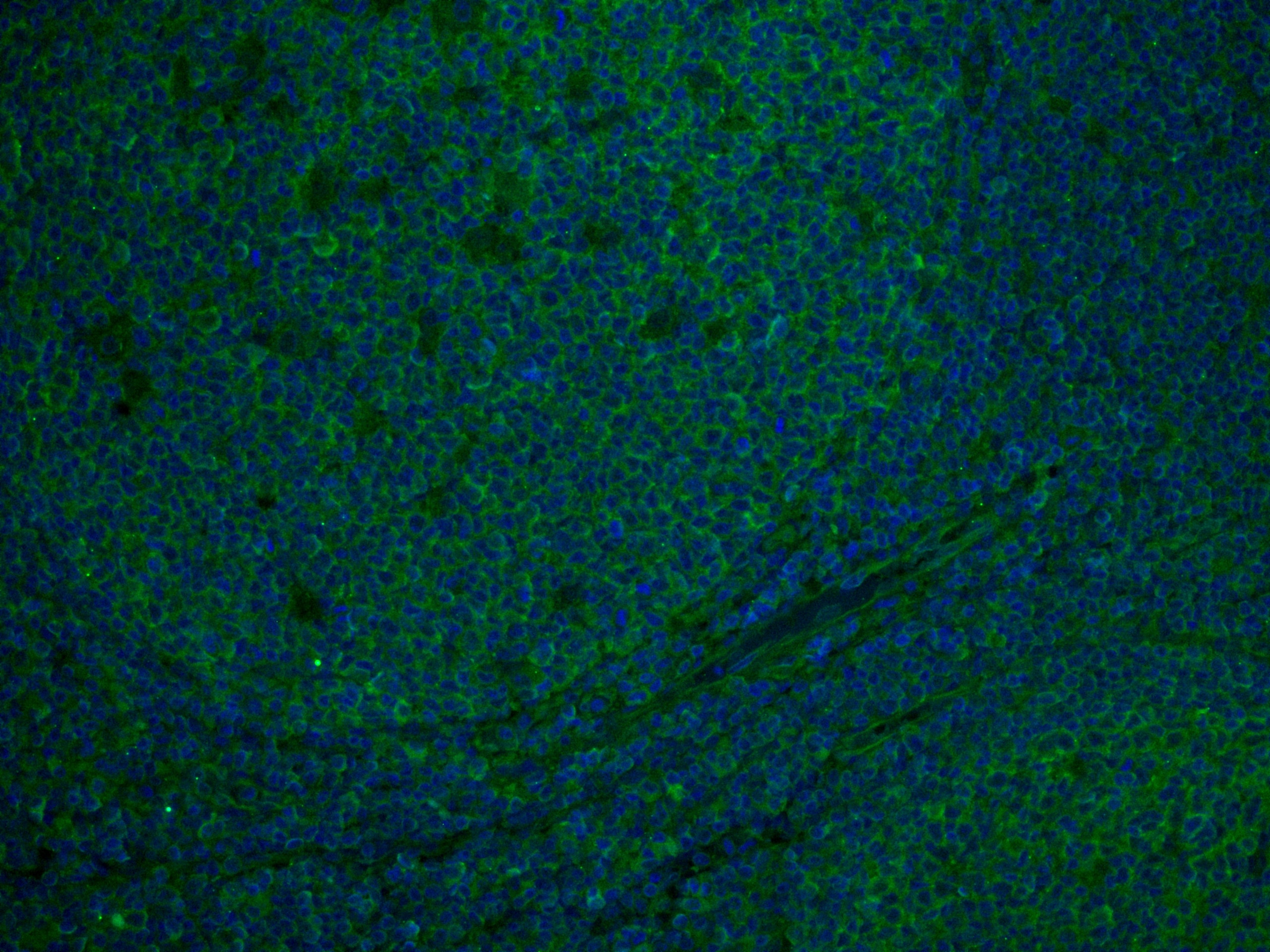 Immunofluorescence (IF) / fluorescent staining of human tonsillitis tissue using CD81 Monoclonal antibody (66866-1-Ig)