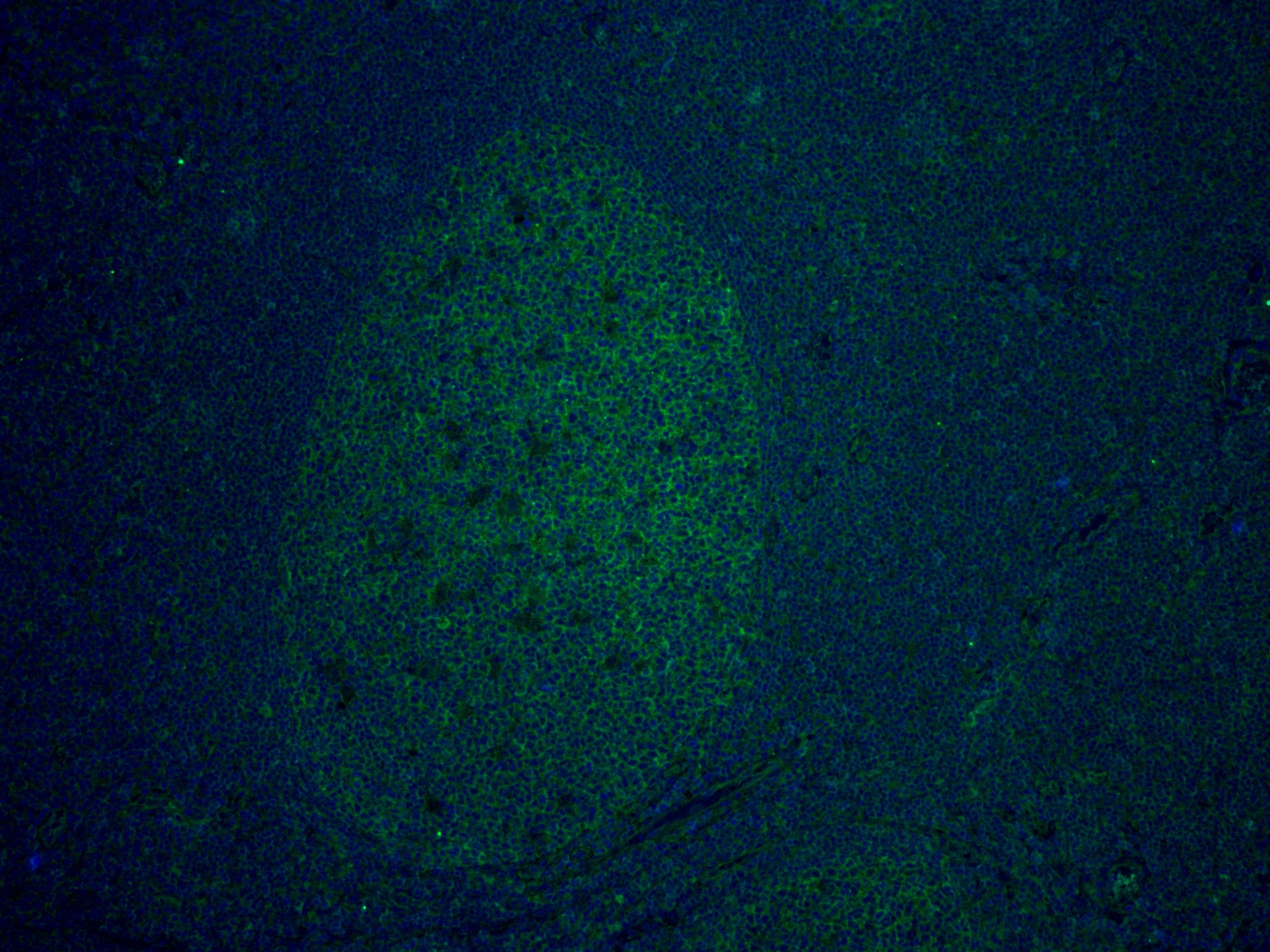 Immunofluorescence (IF) / fluorescent staining of human tonsillitis tissue using CD81 Monoclonal antibody (66866-1-Ig)