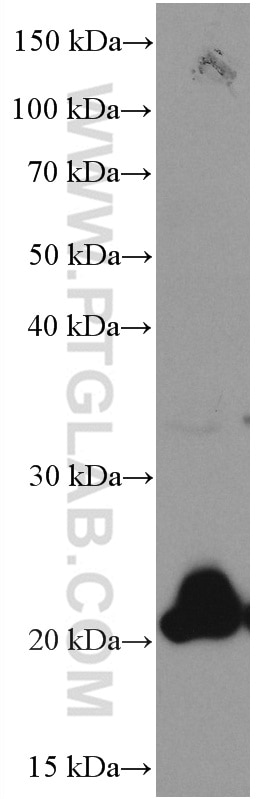 Western Blot (WB) analysis of Jurkat cells using CD81 Monoclonal antibody (66866-1-Ig)