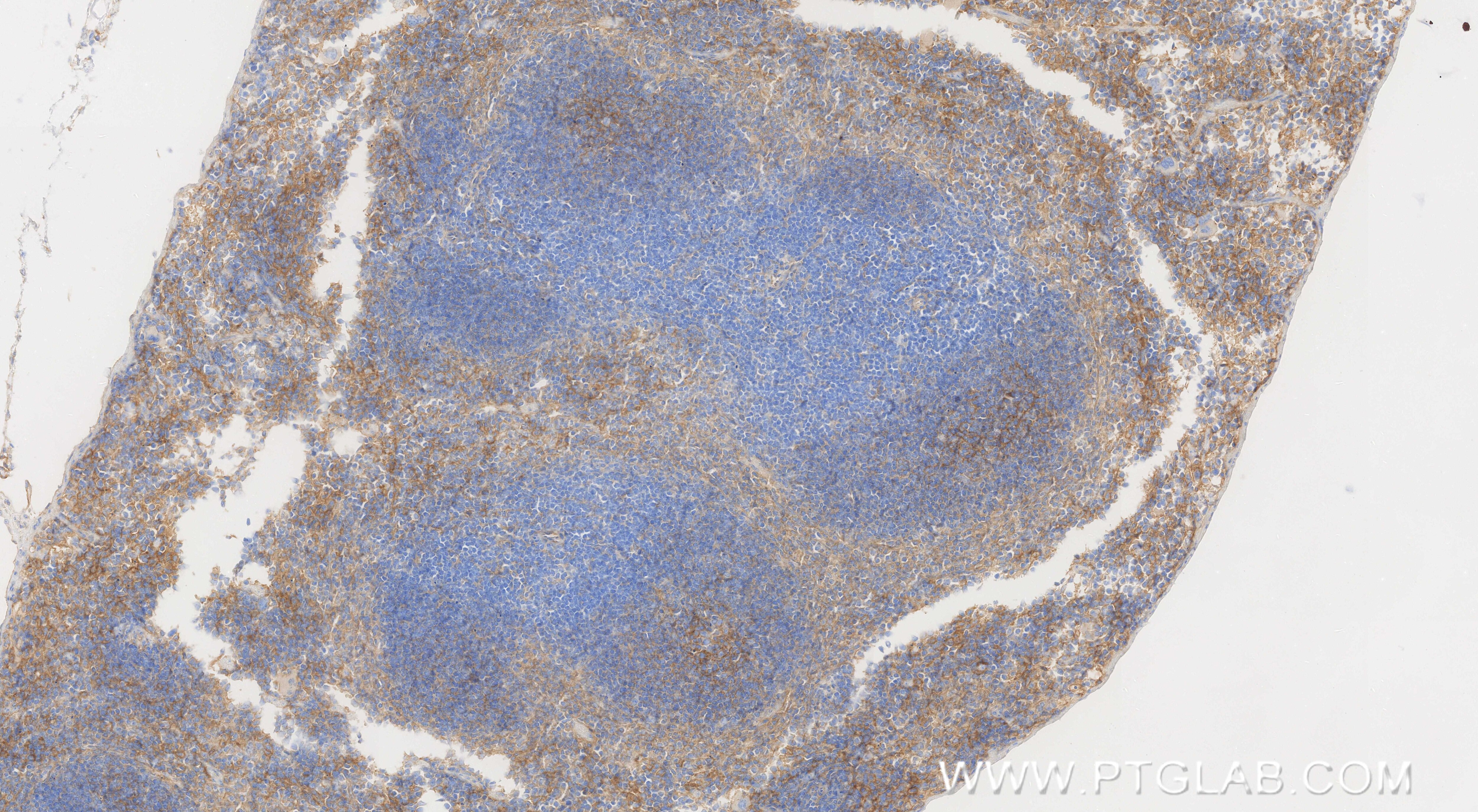 Immunohistochemistry (IHC) staining of mouse spleen tissue using CD81 Recombinant monoclonal antibody (86263-1-RR)