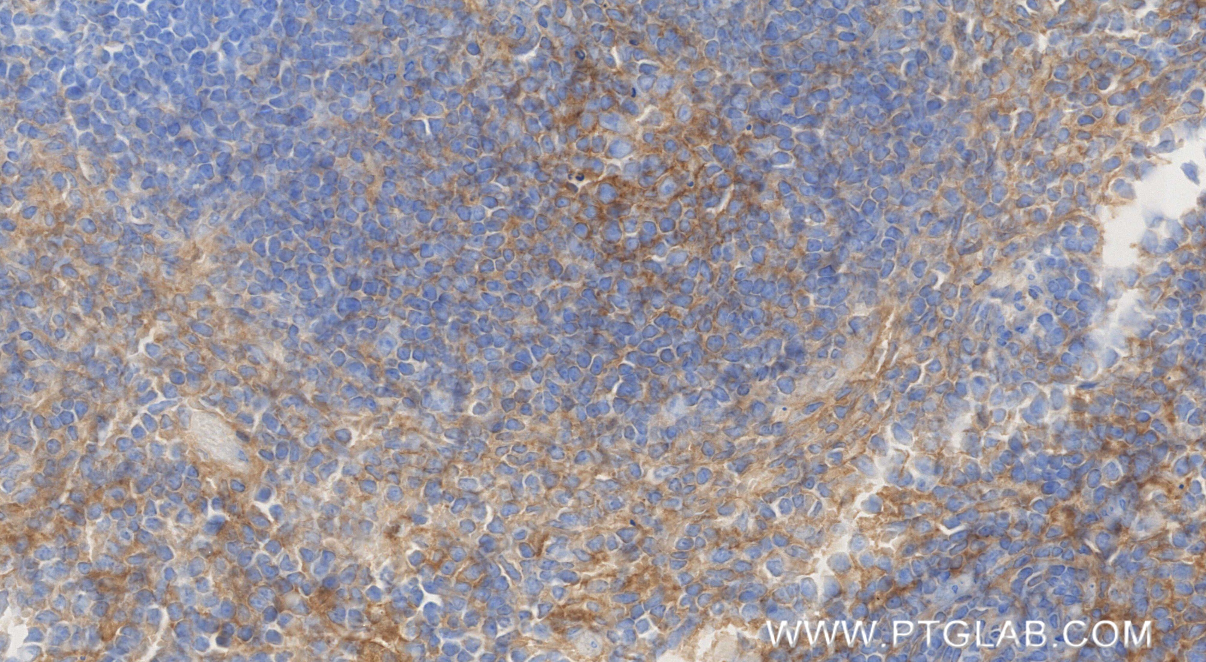 Immunohistochemistry (IHC) staining of mouse spleen tissue using CD81 Recombinant monoclonal antibody (86263-1-RR)