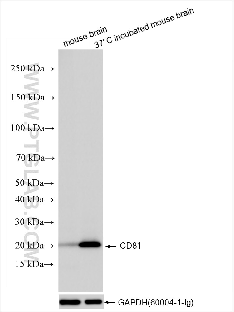Western Blot (WB) analysis of various lysates using CD81 Recombinant antibody (86263-1-RR)
