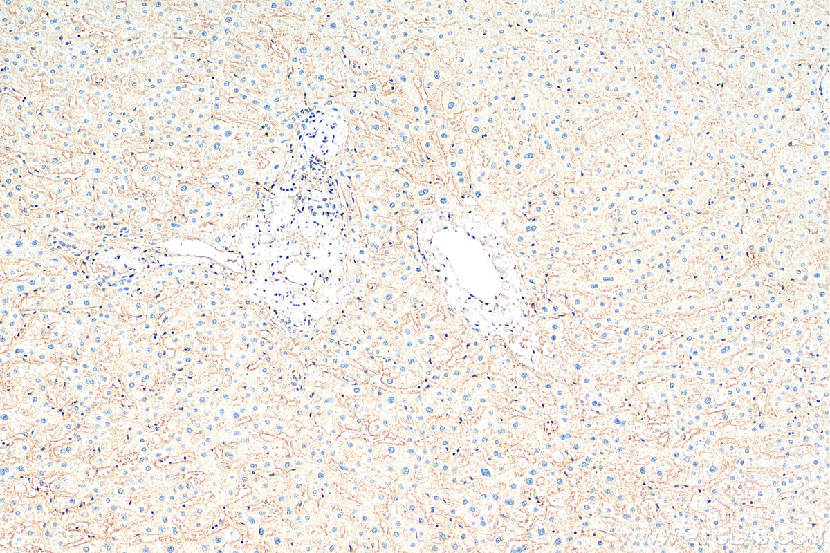 IHC staining of human liver using Biotin-66866
