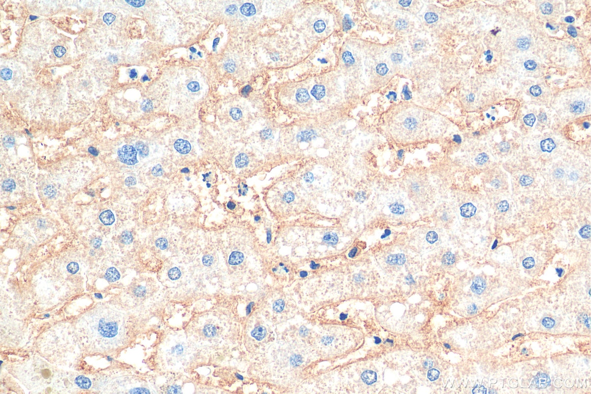 Immunohistochemistry (IHC) staining of human liver tissue using Biotin-conjugated CD81 Monoclonal antibody (Biotin-66866)