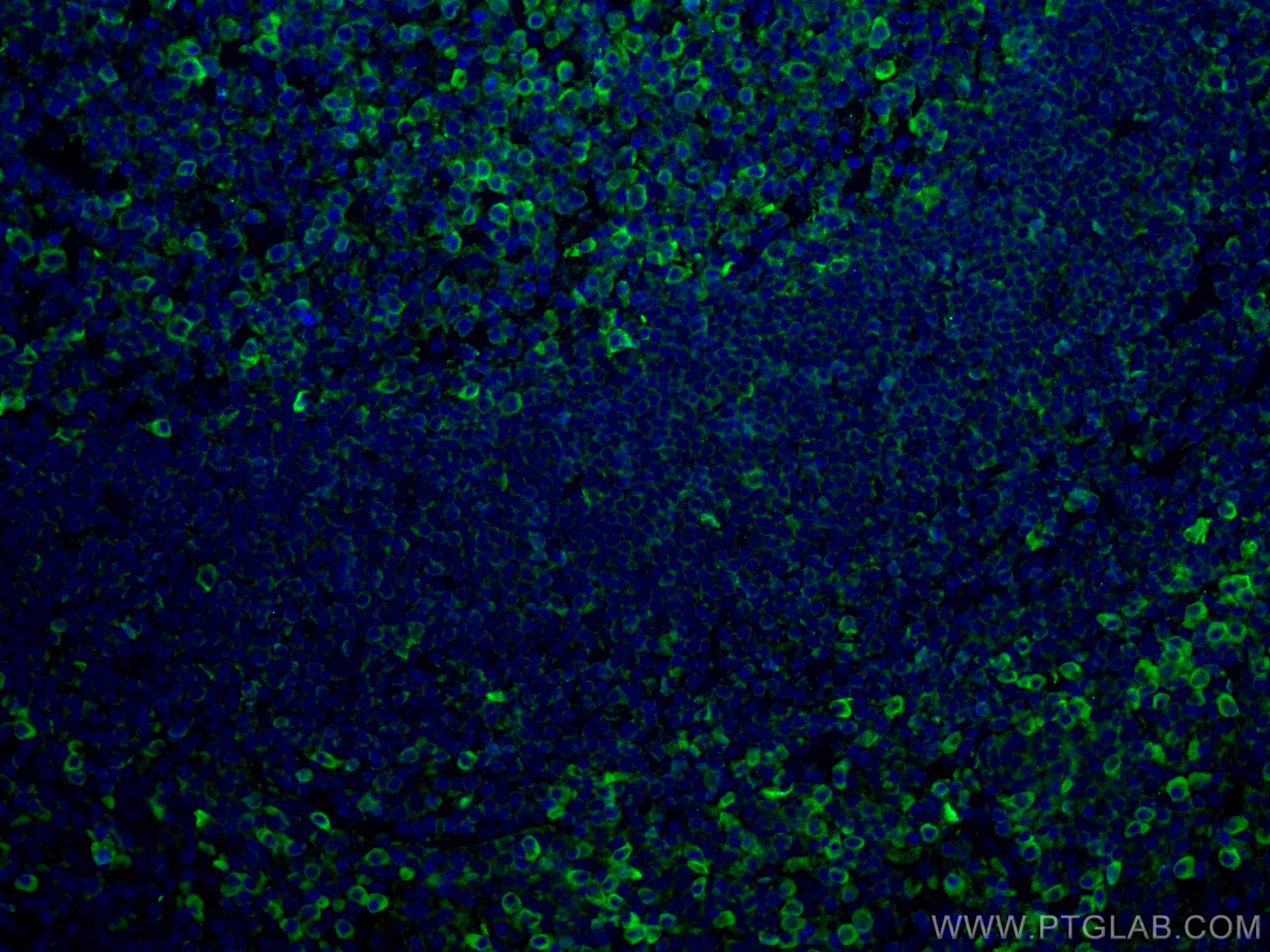 Immunofluorescence (IF) / fluorescent staining of human tonsillitis tissue using CoraLite® Plus 488-conjugated CD81 Monoclonal anti (CL488-66866)