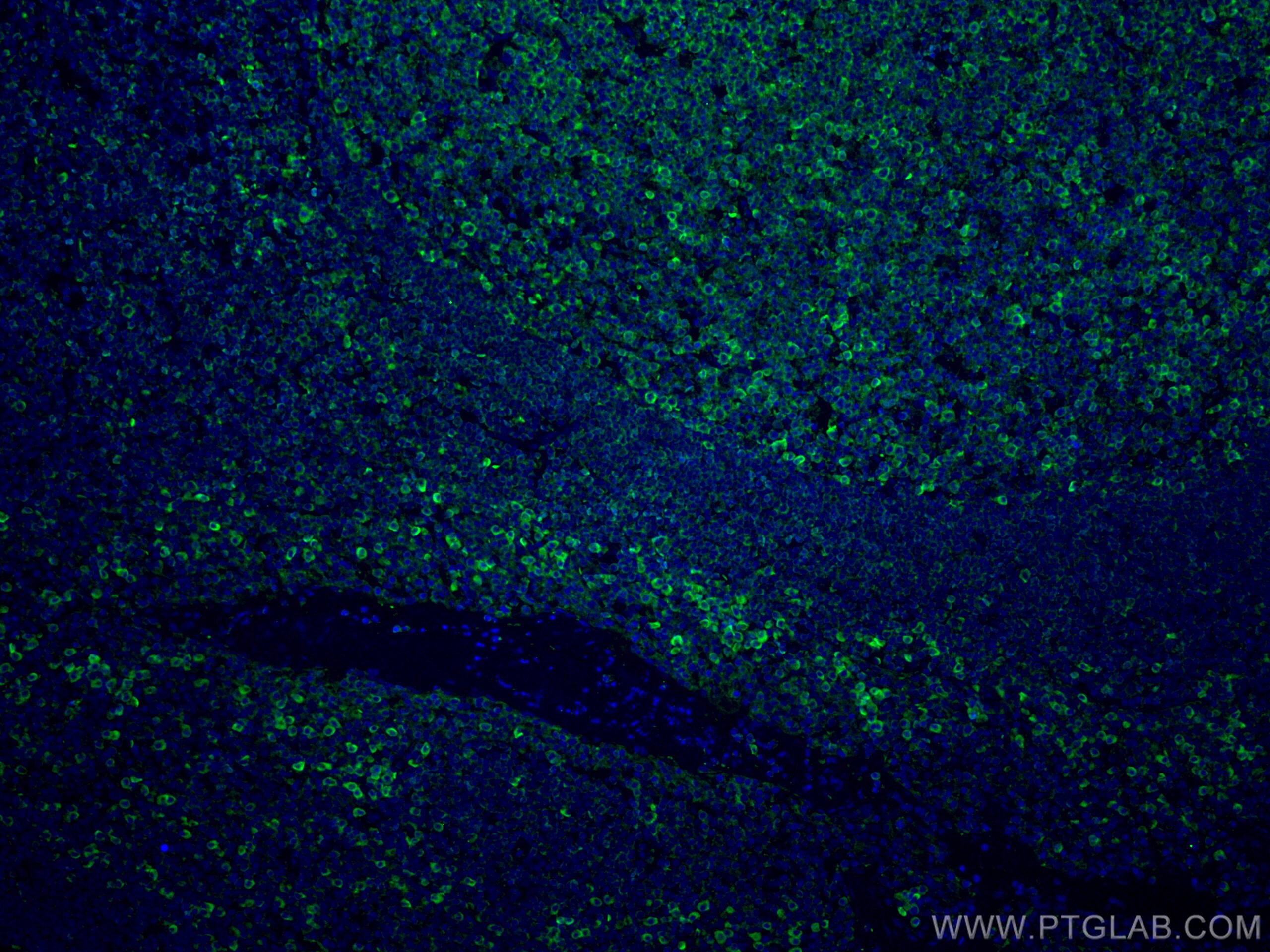 Immunofluorescence (IF) / fluorescent staining of human tonsillitis tissue using CoraLite® Plus 488-conjugated CD81 Monoclonal anti (CL488-66866)