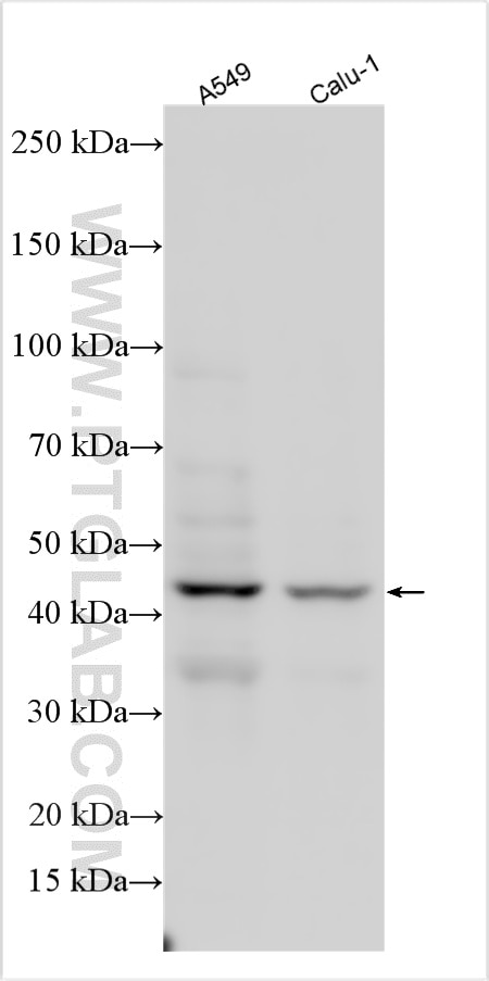 WB analysis using 10248-1-AP Western Blot (WB) analysis of various lysates using CD82 Polyclonal antibody (10248-1-AP)