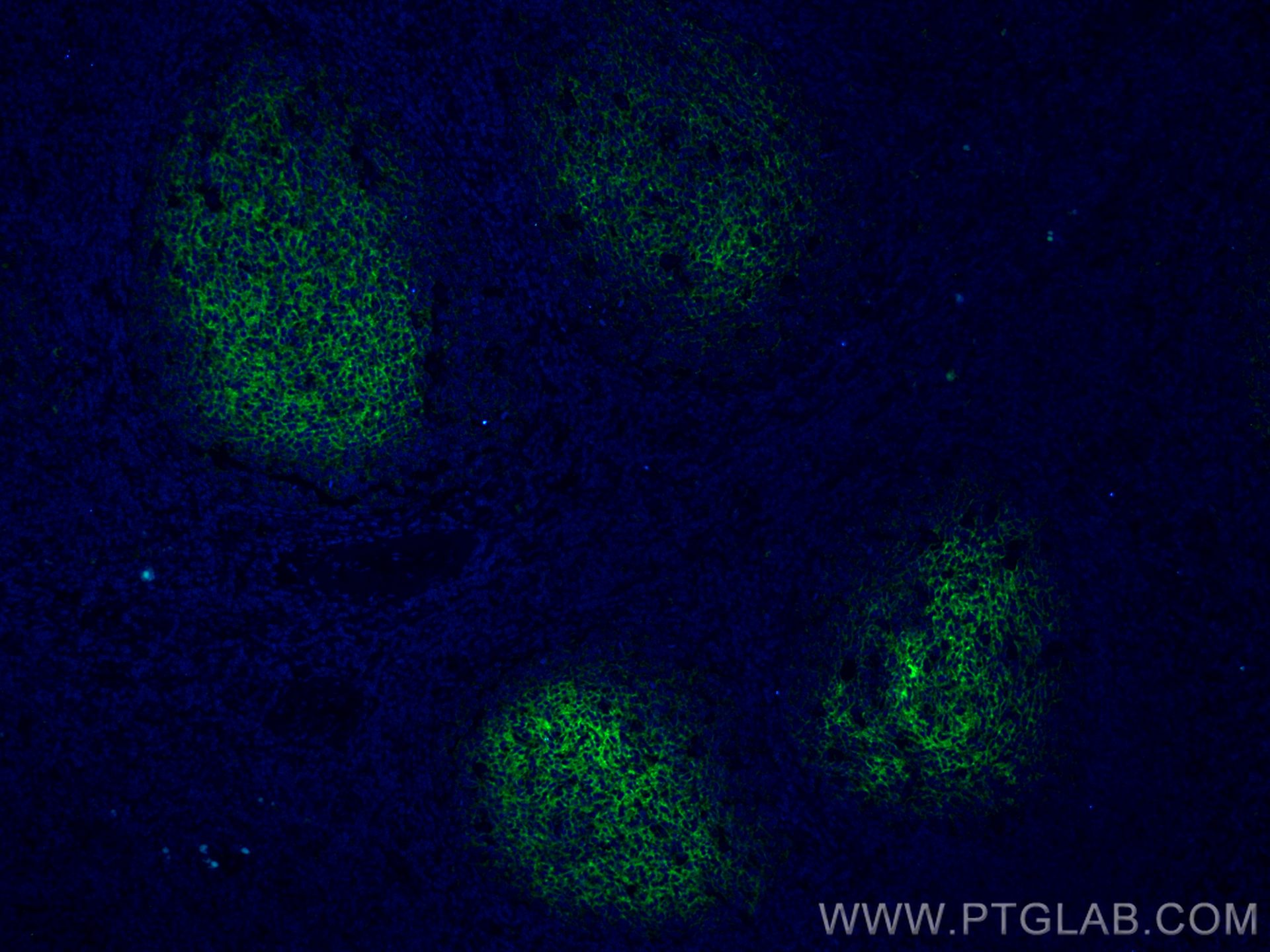 Immunofluorescence (IF) / fluorescent staining of human tonsillitis tissue using CD82 Monoclonal antibody (66803-1-Ig)