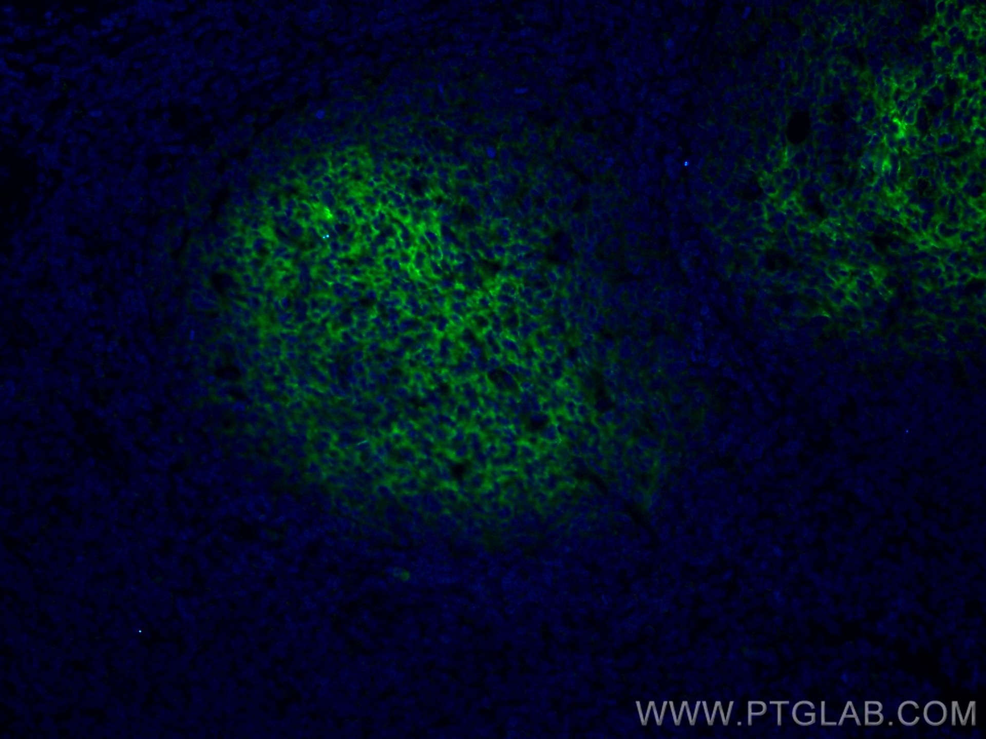 Immunofluorescence (IF) / fluorescent staining of human tonsillitis tissue using CD82 Monoclonal antibody (66803-1-Ig)