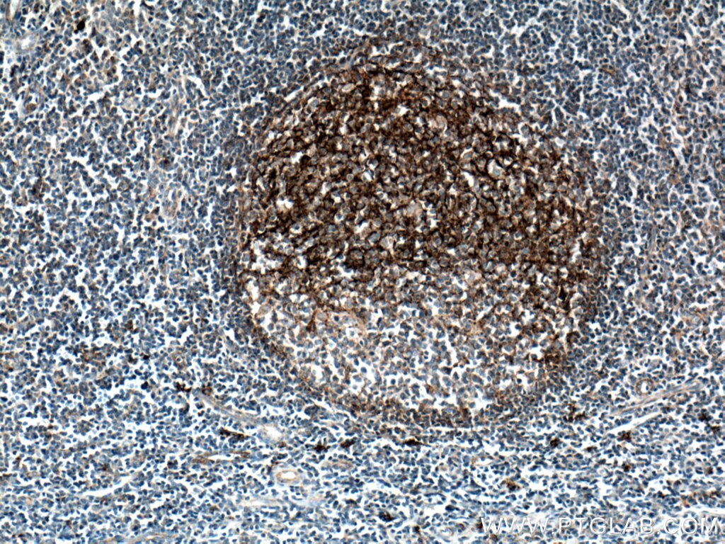 Immunohistochemistry (IHC) staining of human tonsillitis tissue using CD82 Monoclonal antibody (66803-1-Ig)