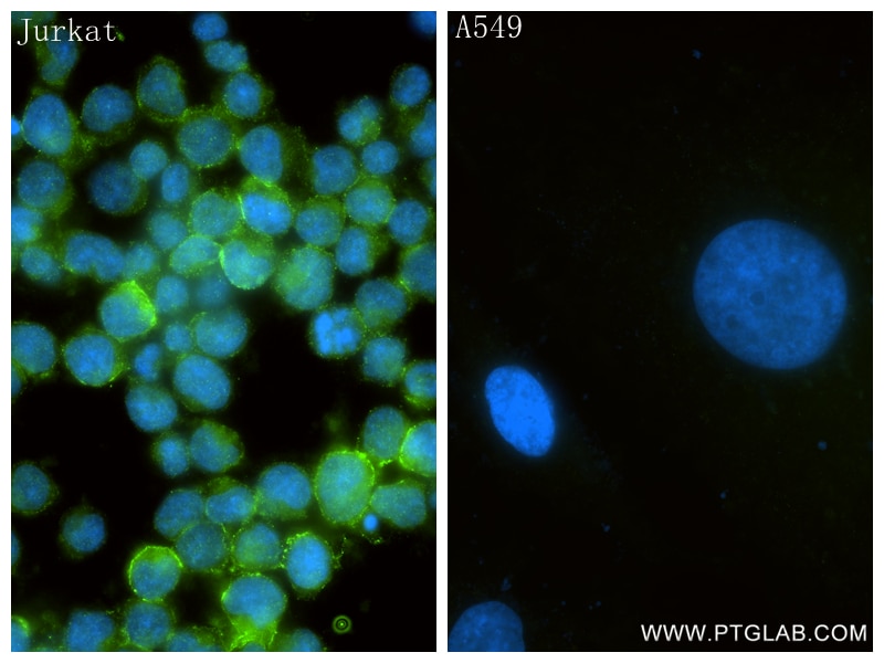 Immunofluorescent analysis of (4% PFA) fixed Jurkat cells using CD82 antibody (84617-7-RR, Clone: 241765G7 ) at dilution of 1:500 and CoraLite®488-Conjugated Goat Anti-Rabbit IgG(H+L) (SA00013-2). Immunofluorescence (IF) / fluorescent staining of Jurkat cells using CD82 Recombinant monoclonal antibody (84617-7-RR)