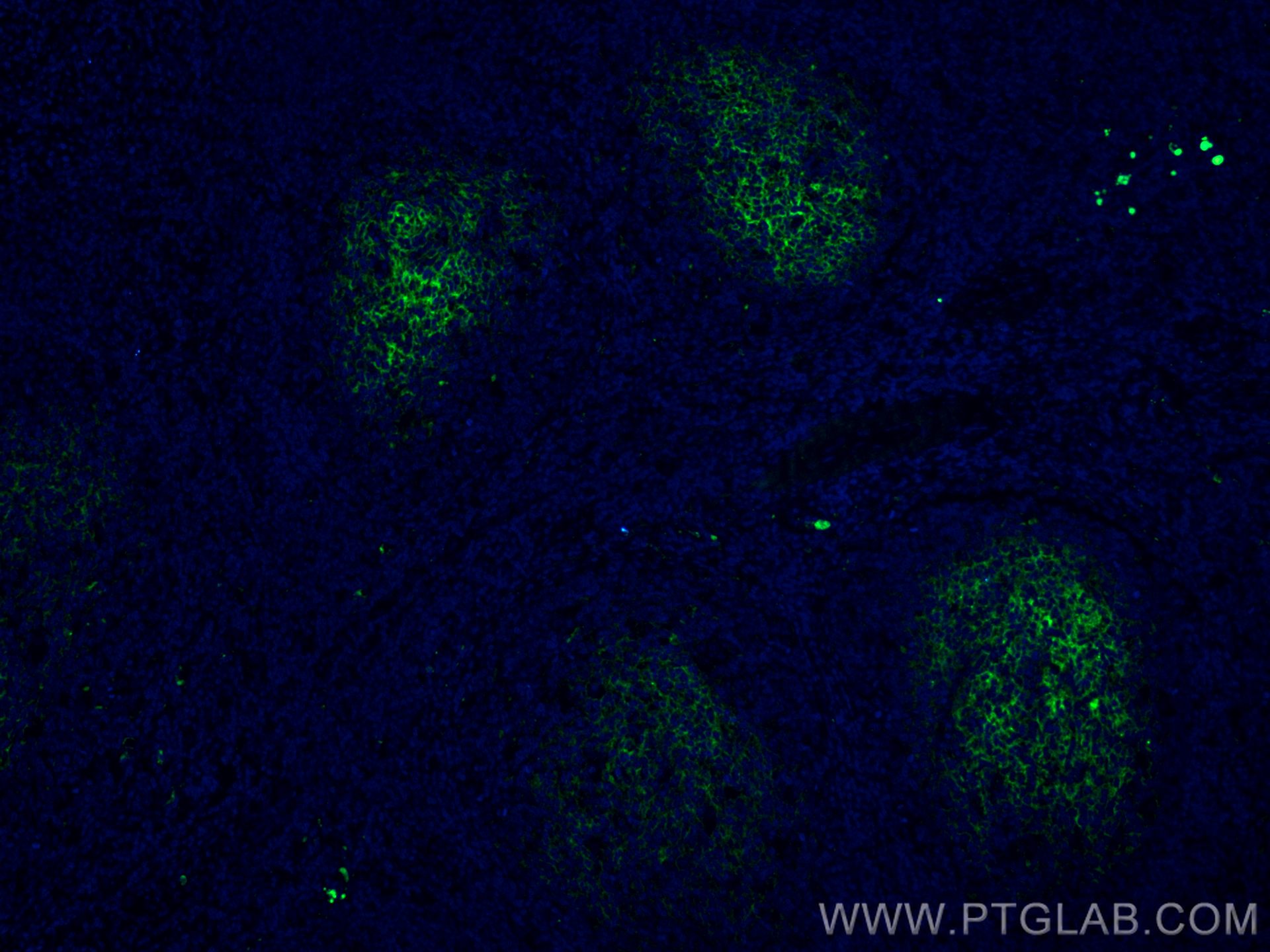 Immunofluorescence (IF) / fluorescent staining of human tonsillitis tissue using CoraLite® Plus 488-conjugated CD82 Monoclonal anti (CL488-66803)