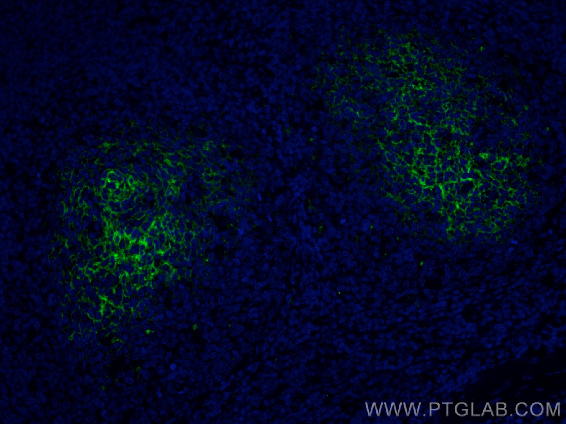 Immunofluorescence (IF) / fluorescent staining of human tonsillitis tissue using CoraLite® Plus 488-conjugated CD82 Monoclonal anti (CL488-66803)