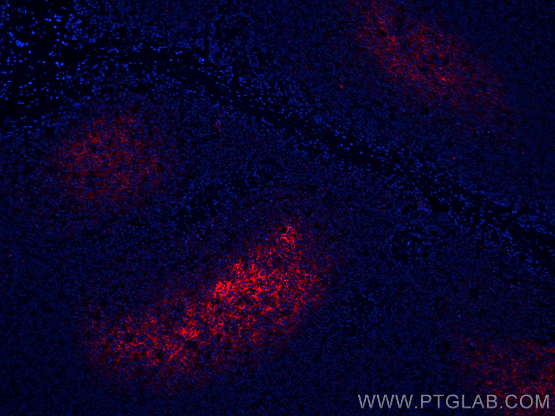 Immunofluorescence (IF) / fluorescent staining of human tonsillitis tissue using CoraLite®594-conjugated CD82 Monoclonal antibody (CL594-66803)