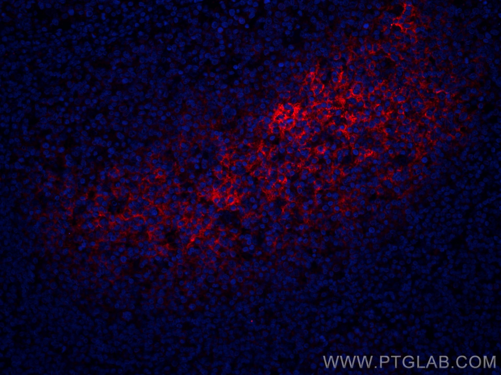 Immunofluorescence (IF) / fluorescent staining of human tonsillitis tissue using CoraLite®594-conjugated CD82 Monoclonal antibody (CL594-66803)