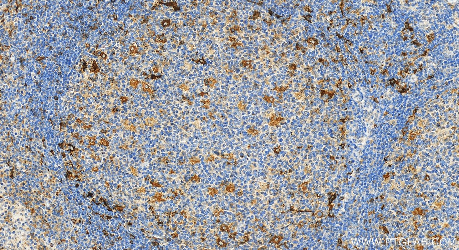 Immunohistochemistry (IHC) staining of human tonsillitis tissue using CD83 Polyclonal antibody (32149-1-AP)