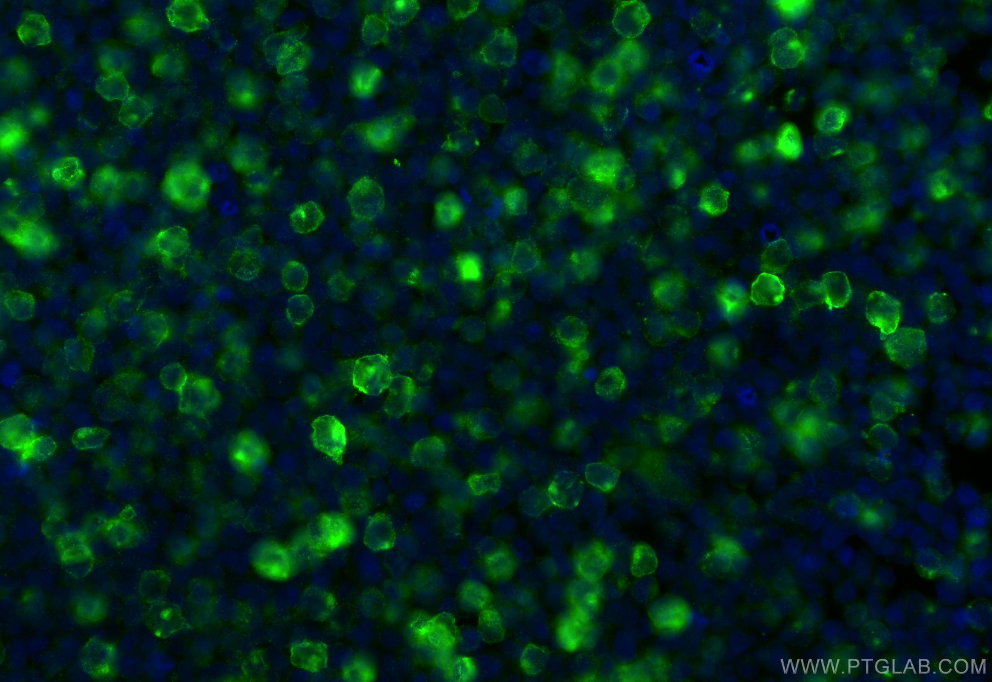 Immunofluorescence (IF) / fluorescent staining of Raji cells using Anti-Human CD83 (HB15e) Mouse IgG2a Recombinant An (65581-1-MR)