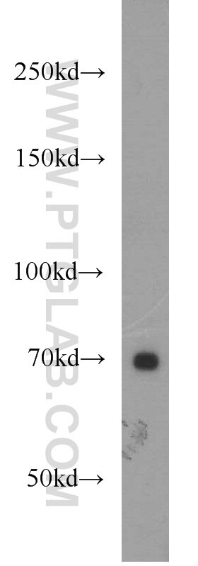 CD84